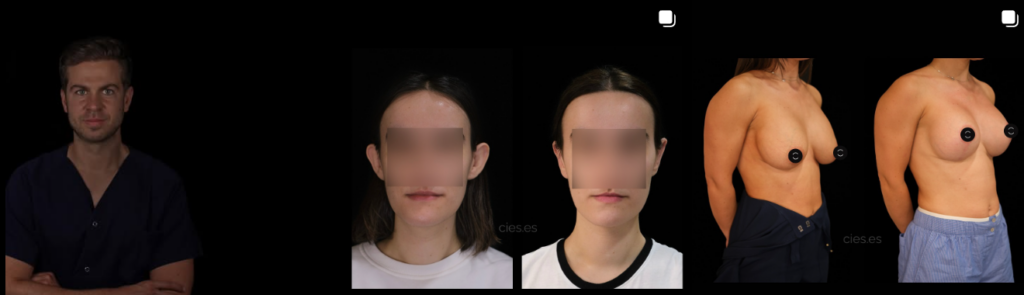 Publicación de Instagram de CIES Cirugía y Estética – Dr. Roi Rogel Vence